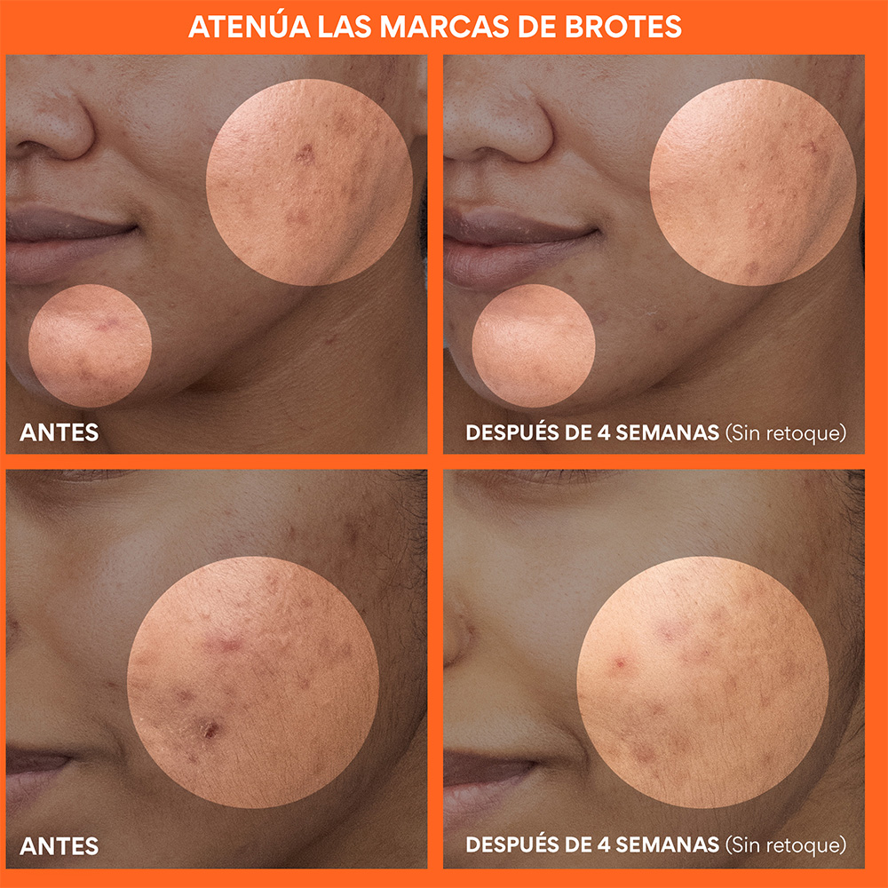 DAILY VITAMIN C KOREAN BRIGHTENING TONER PADS WITH NIACINAMIDE FOR DARK SPOTS (PADS DE T&Oacute;NICO CON VITAMINA C)